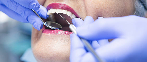 Best Urgent Care for Lost Fillings or Crowns in New Ellenton, SC