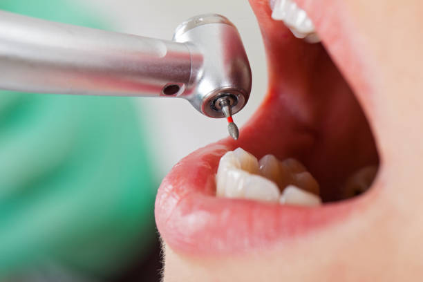 Best Emergency Denture Repair in New Ellenton, SC